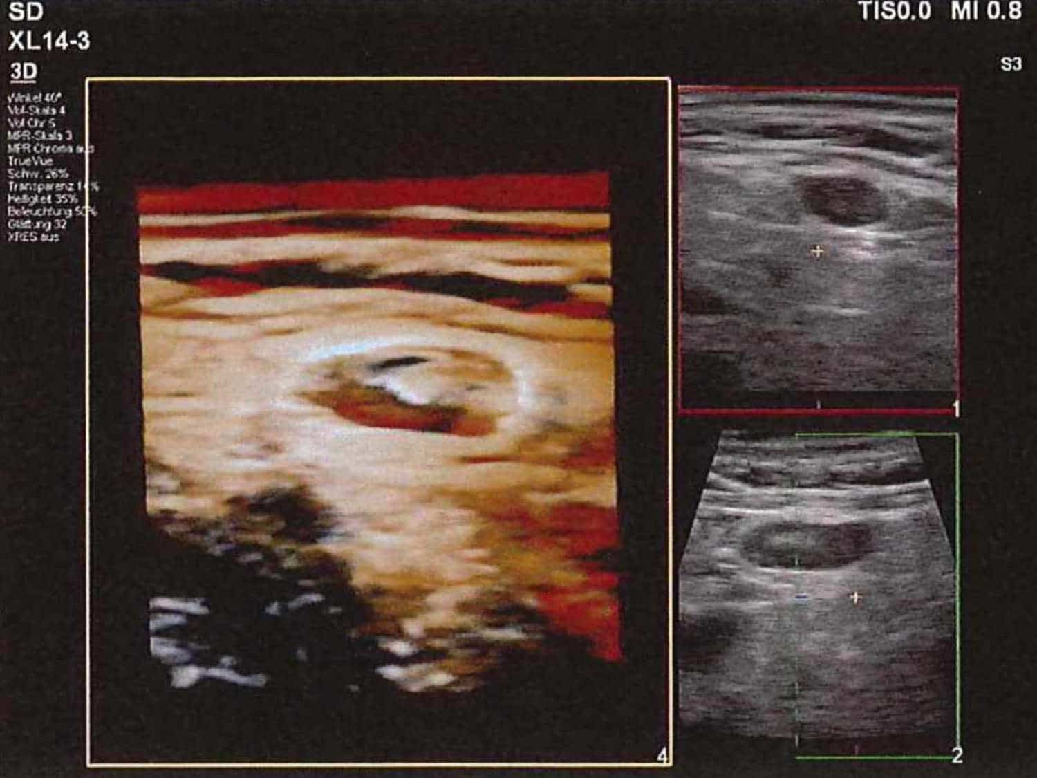 Ausschnitte eines Bildschirms mit Ultraschallaufnahmen